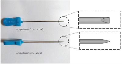 The ultrasound-guided percutaneous release technique for De Quervain's disease using an acupotomy